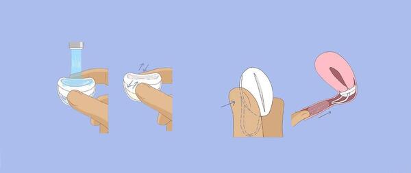 عکس اسفنج ضد بارداری