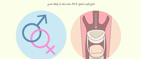 عکس اسفنج ضد بارداری