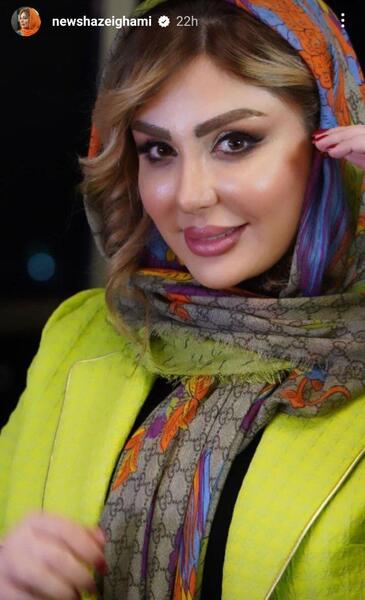 عکس رنگ موی نیوشا ضیغمی