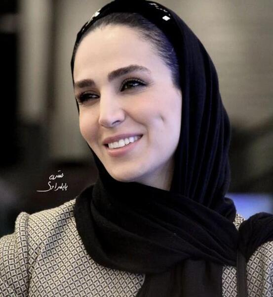 عکس صورت سوگل طهماسبی