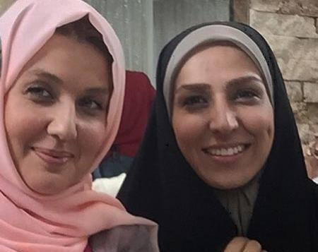 عکس صورت سوگل طهماسبی