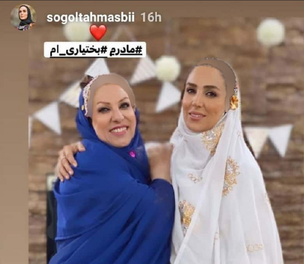 عکس صورت سوگل طهماسبی
