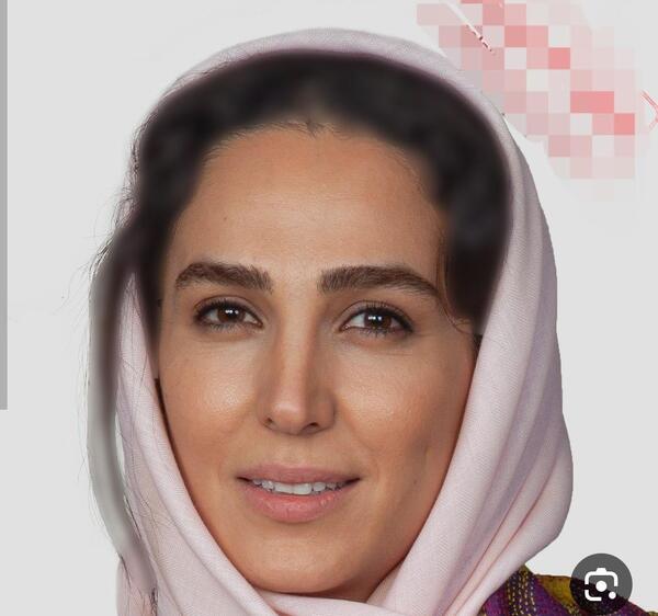 عکس صورت سوگل طهماسبی