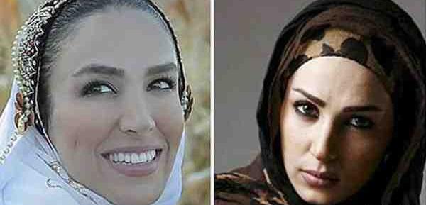 عکس صورت سوگل طهماسبی