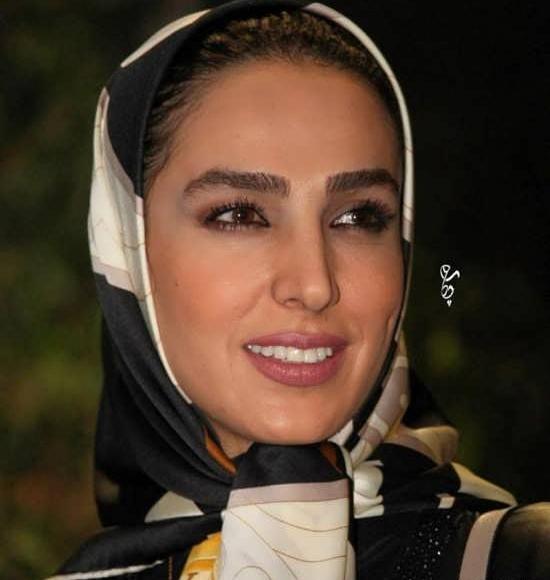 عکس صورت سوگل طهماسبی