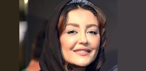 عکس قبل عمل زیبایی شقایق فراهانی