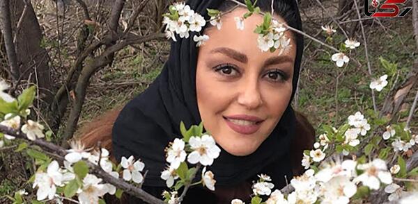 عکس قبل عمل زیبایی شقایق فراهانی
