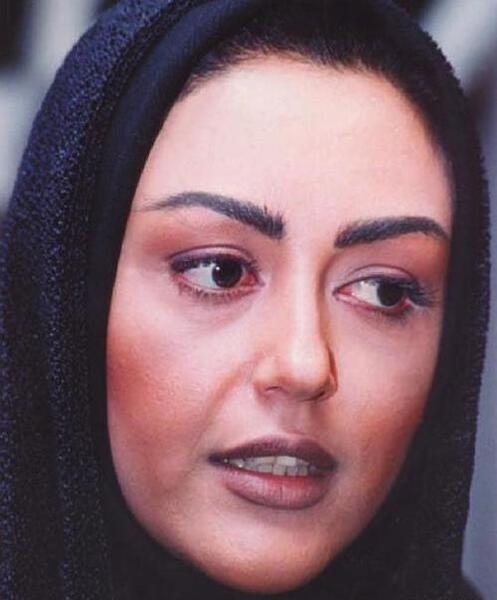 عکس قبل عمل زیبایی شقایق فراهانی