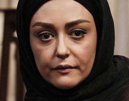 عکس قبل عمل زیبایی شقایق فراهانی