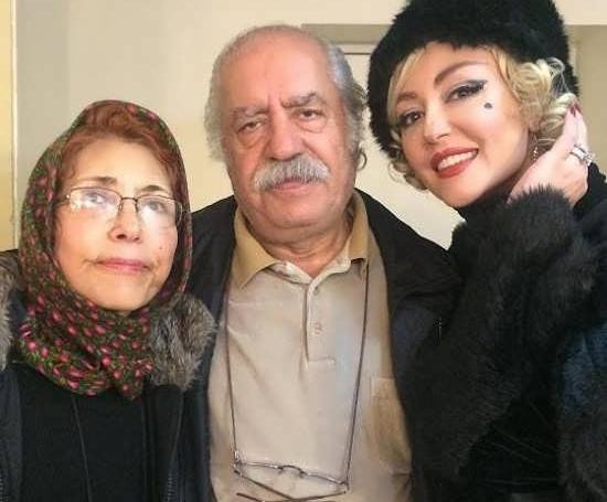 عکس قبل عمل زیبایی شقایق فراهانی