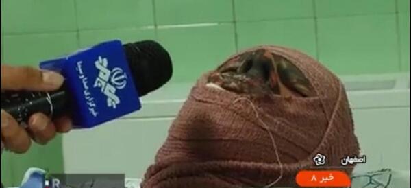 عکس حوادث چهارشنبه سوری ۱۴۰۰