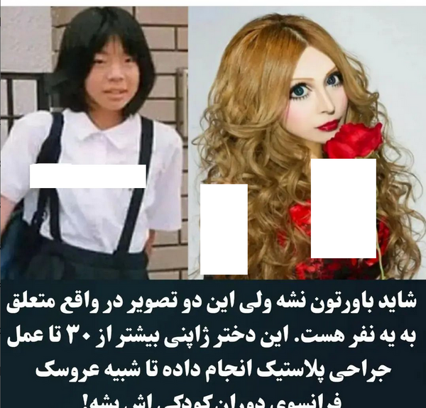 عکس باربی واقعی قبل از عمل