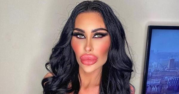عکس باربی واقعی قبل از عمل