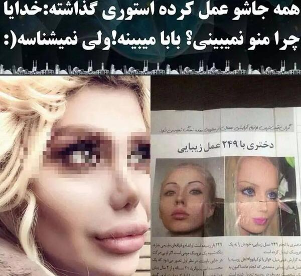 عکس باربی واقعی قبل از عمل