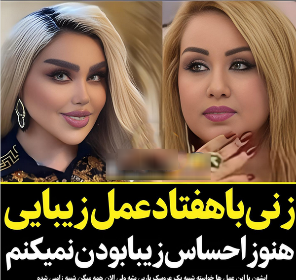 عکس باربی واقعی قبل از عمل