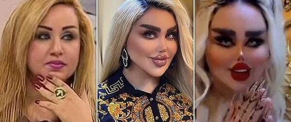 عکس باربی واقعی قبل از عمل