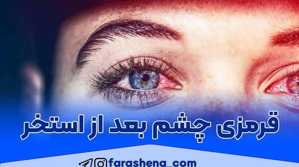 عکس قرمز شدن چشم در استخر