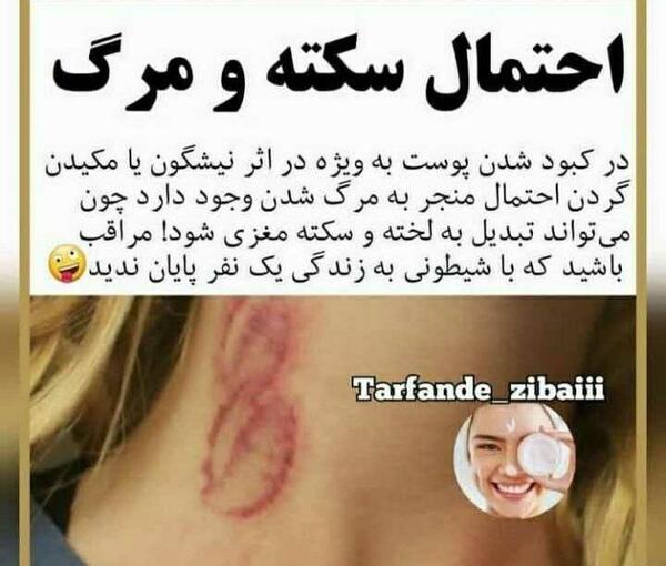 عکس کبودی آزاده نامداری