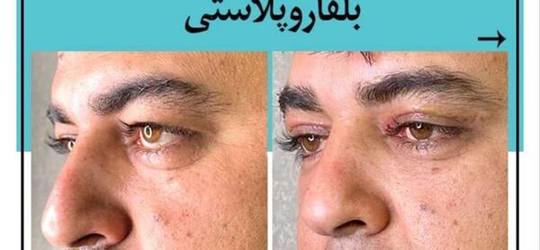 عکس چشم یار
