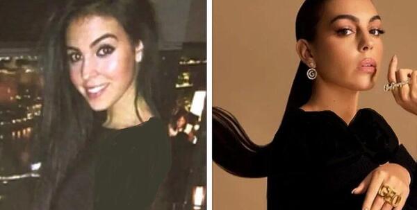عکس رونالدو قبل و بعد