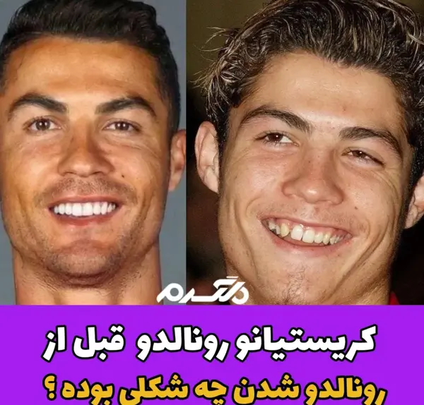 عکس رونالدو قبل و بعد