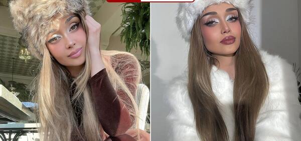 عکس الناز گلرخ قبل از عمل