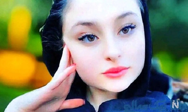 عکس قبل عمل صورت نیما فلاحی