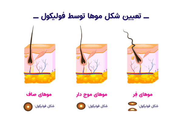 عکس ساختمان مو