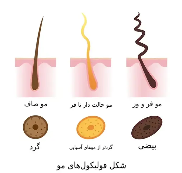 عکس ساختمان مو