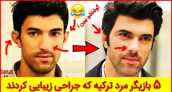 عکس زلیخا قبل از عمل زیبایی در فیلم چوکوروا