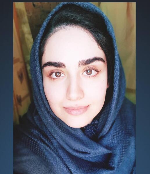 عکس هانیه غلامی قبل از عمل