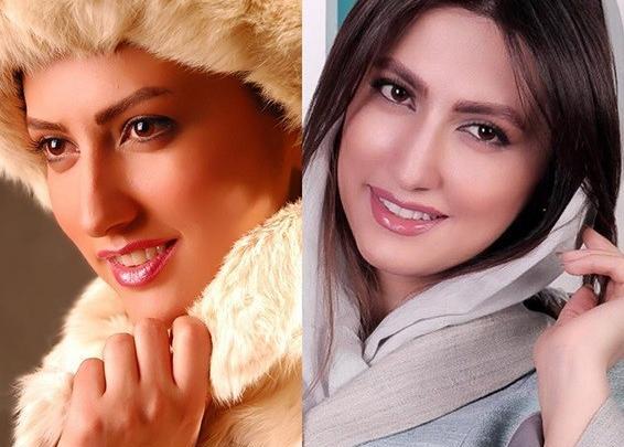 عکس هانیه غلامی قبل از عمل
