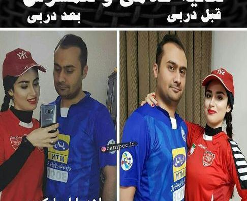 عکس هانیه غلامی قبل از عمل