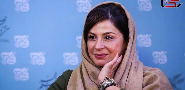 عکس سیما تیرانداز قبل عمل بینی