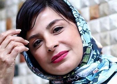 عکس سیما تیرانداز قبل عمل بینی