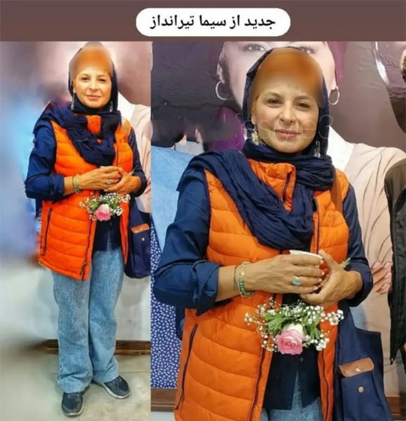 عکس سیما تیرانداز قبل عمل بینی