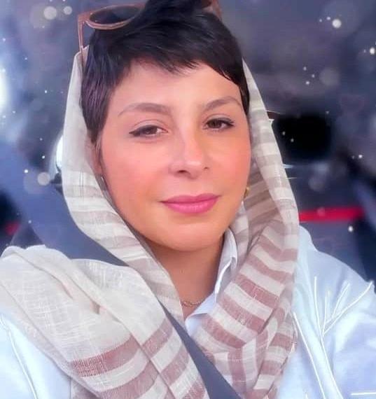 عکس سیما تیرانداز قبل عمل بینی