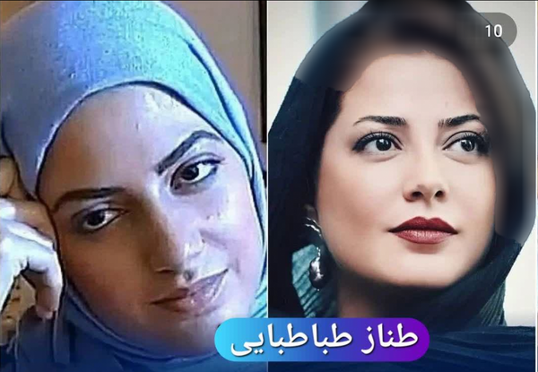 عکس سیما تیرانداز قبل عمل بینی