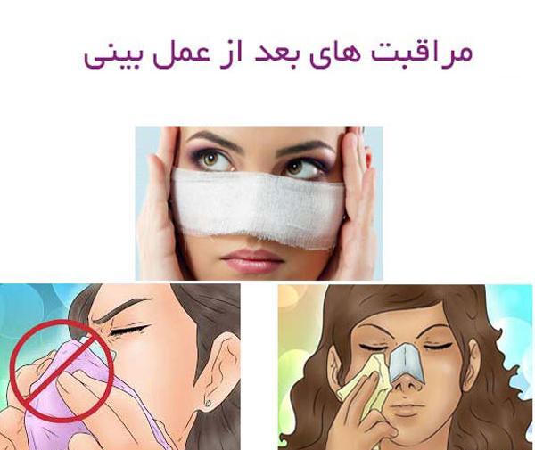 عکس روز اول عمل بینی