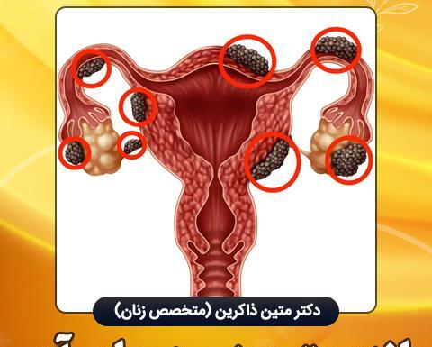 عکس بافت آندومتریوز