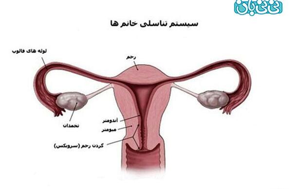 عکس بافت آندومتریوز