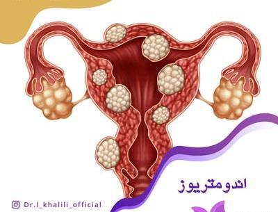عکس بافت آندومتریوز