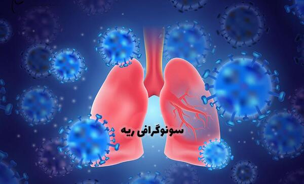 عکس سه بعدی ریه