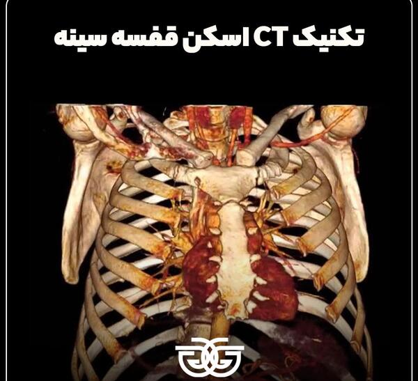 عکس سه بعدی ریه