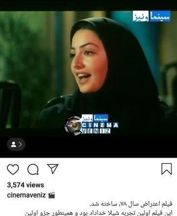 عکس شیلا خداداد قبل از عمل بینی