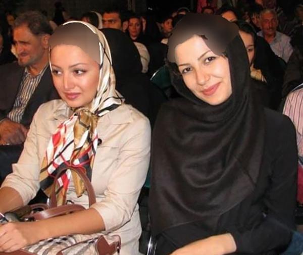 عکس شیلا خداداد قبل از عمل بینی