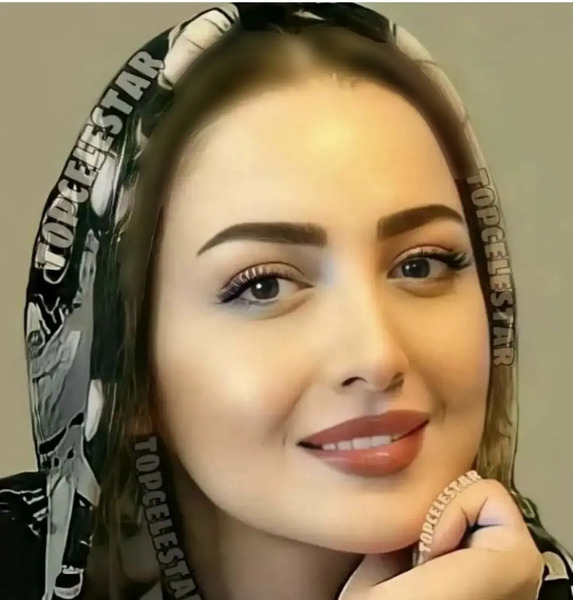 عکس شیلا خداداد قبل از عمل بینی