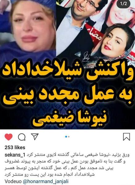 عکس شیلا خداداد قبل از عمل بینی