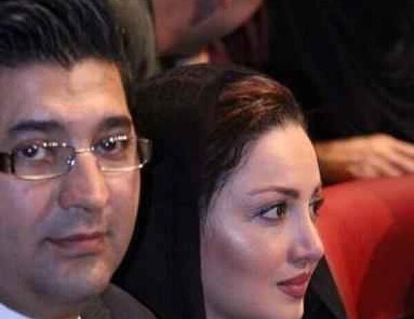 عکس شیلا خداداد قبل از عمل بینی