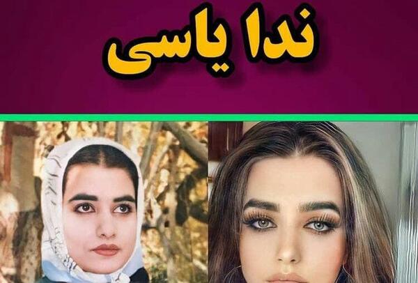عکس دنیا جهانبخت قبل و بعد از عمل